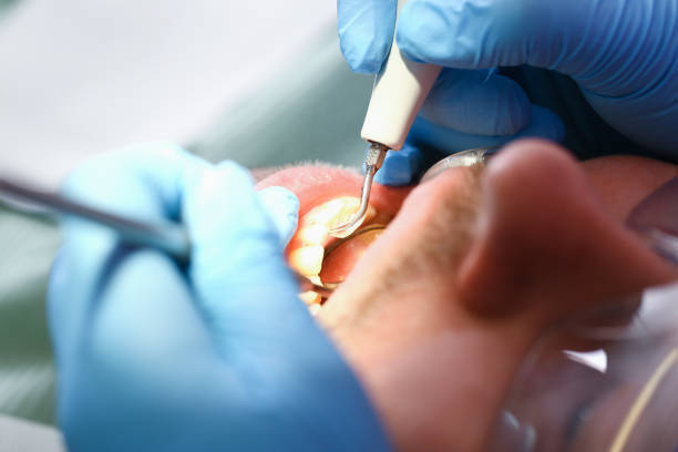 Best Emergency Denture Repair in Monroe, WI