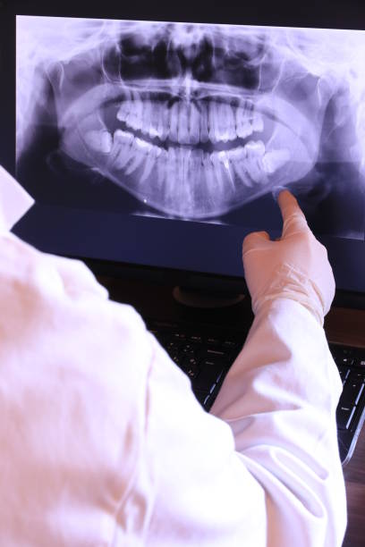 Best Emergency Root Canal Treatment in Monroe, WI